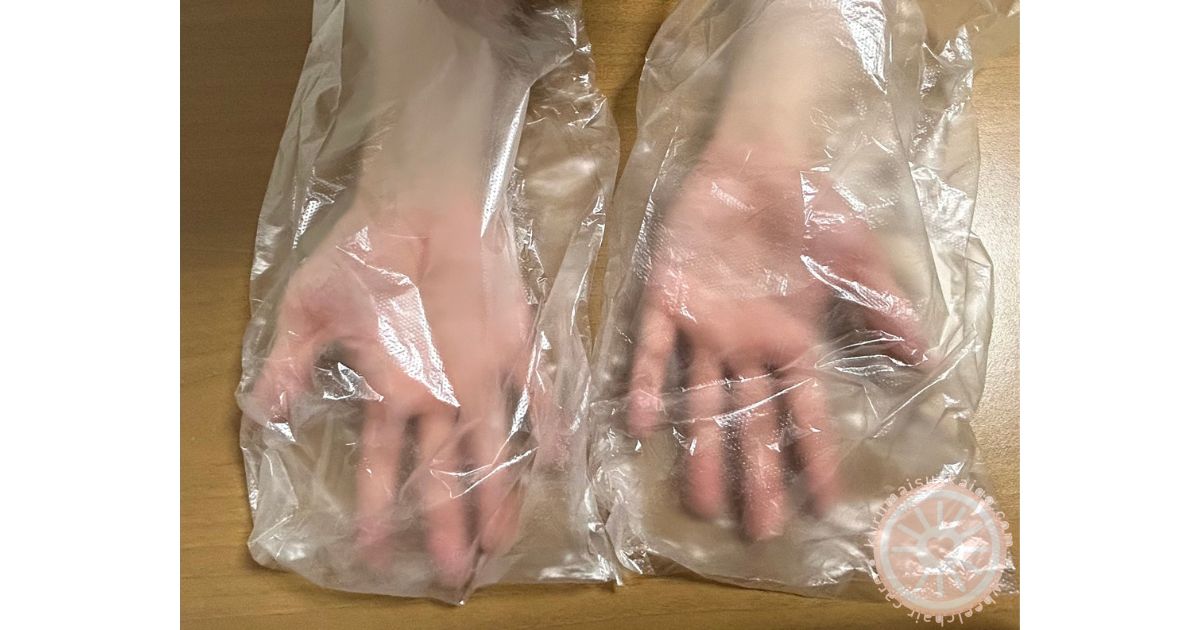介助グローブの代用として両手にはめた薄いポリ袋